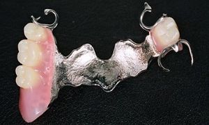Зубные протезы съемные при частичном отсутствии зубов