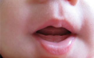 Ребенку 11 месяцев нет зубов почему