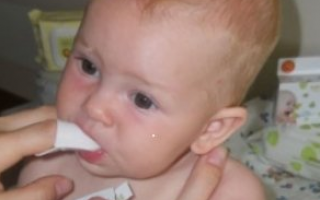 У младенца белый налет во рту