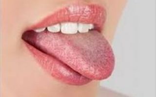 Воспаление полости рта и языка